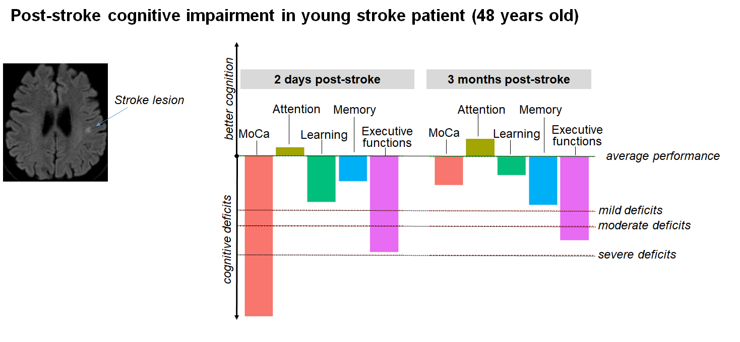 graph showing improvement in cognition after acute stroke